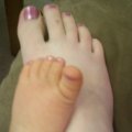 Kylee foot, june 7, 2008 (1)